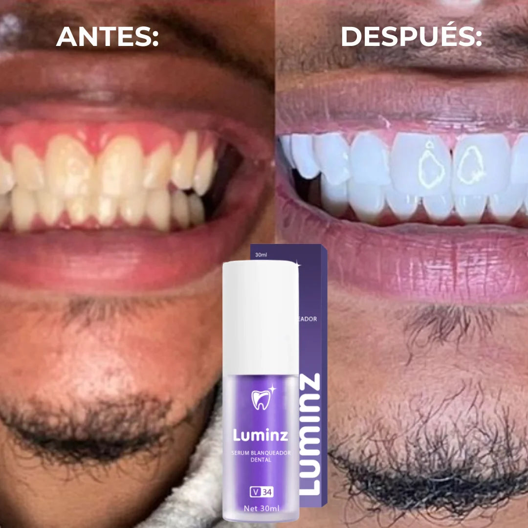Serum Blanqueador Dental V34 LUMINZ - ¡Porque tu sonrisa es tu carta de presentación!